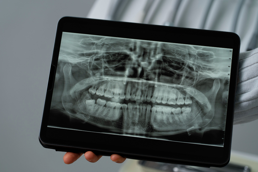 Снимок зубов: 3D КТ 
сканирование челюсти