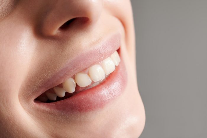 Коррекция десневой улыбки в Dava Dental Clinic